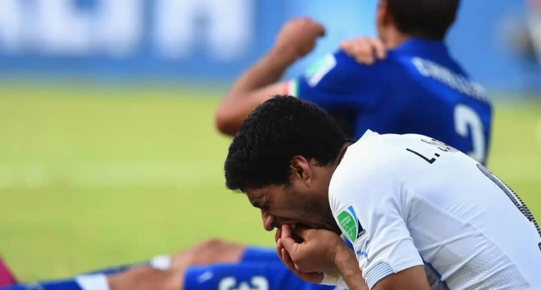 على خطى سواريز .. “عضة” غريبة تشعل دوري عالمي